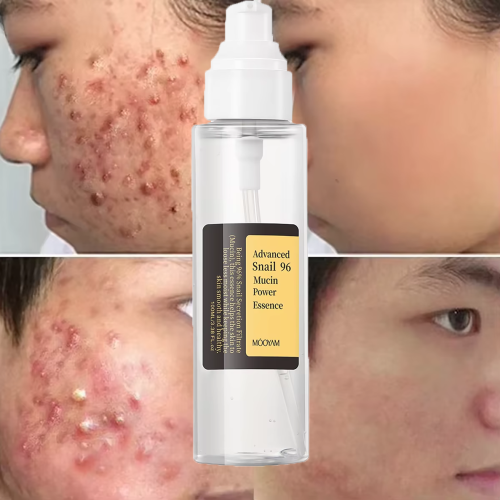 Snail Mucin Repairing Essence Moisturizer Glowing Skin Improving Skin Elasticity Moisturizing Lightweight Face Snail Serum